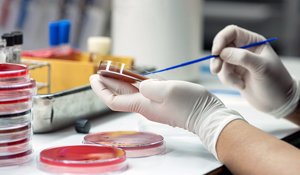 Lab culture testing