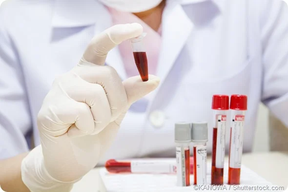 Clinical Chemistry